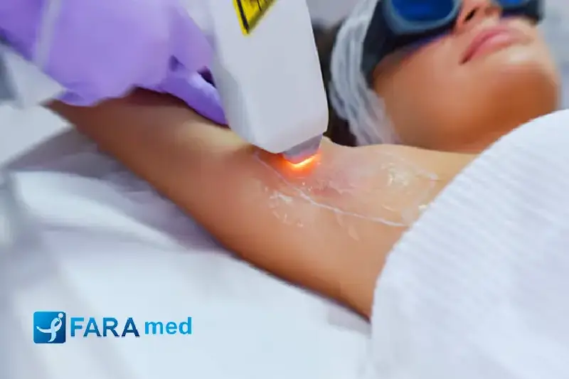 نکات قبل از خرید دستگاه لیزر