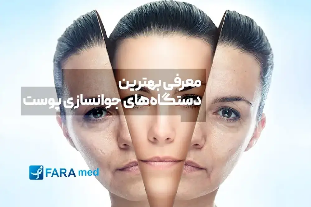 معرفی بهترین دستگاه‌های جوانسازی پوست