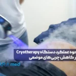 کرایوتراپی یا سرما درمانی چیست؟ بررسی انواع دستگاه‌های کرایو