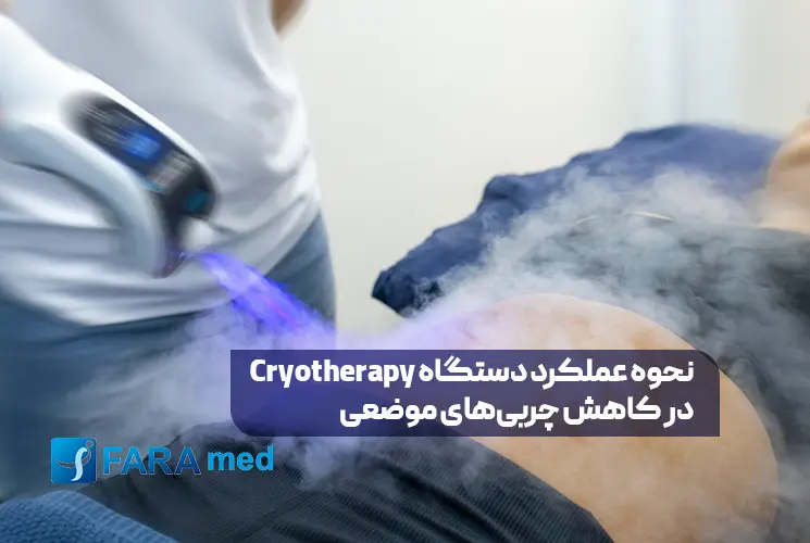 کرایوتراپی یا سرما درمانی چیست؟ بررسی انواع دستگاه‌های کرایو