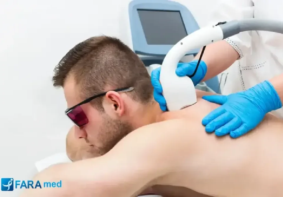 لیزر مو های زائد بدون درد