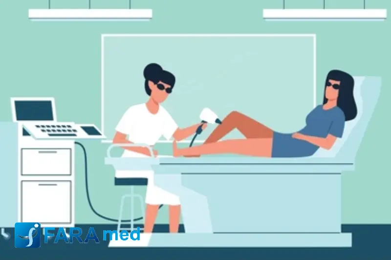 لیزر مو های زائد