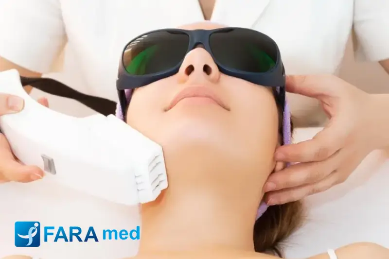 لیزر مو های زائد