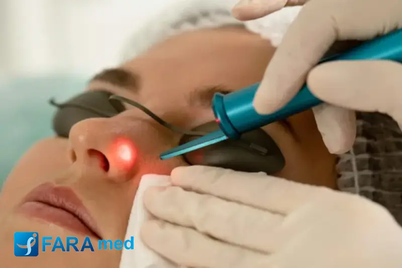 پیکوثانیه یا کیوسوئیچ؟ مقایسه جامع دو تکنولوژی برتر برای ریموال تتو