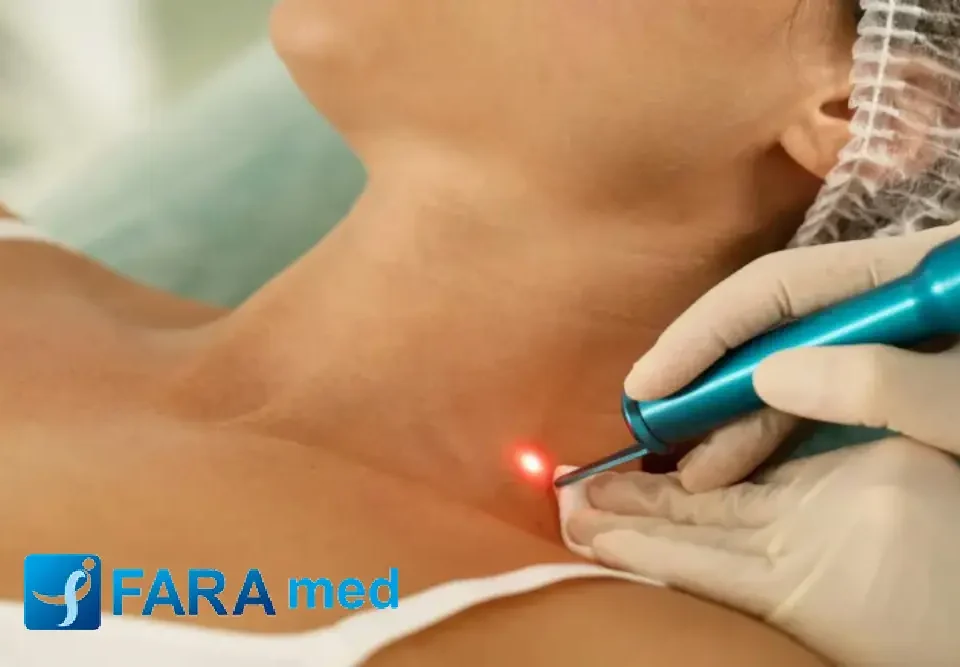 پیکوثانیه یا کیوسوئیچ؟ مقایسه جامع دو تکنولوژی برتر برای ریموال تتو