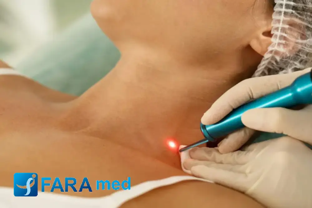 پیکوثانیه یا کیوسوئیچ؟ مقایسه جامع دو تکنولوژی برتر برای ریموال تتو