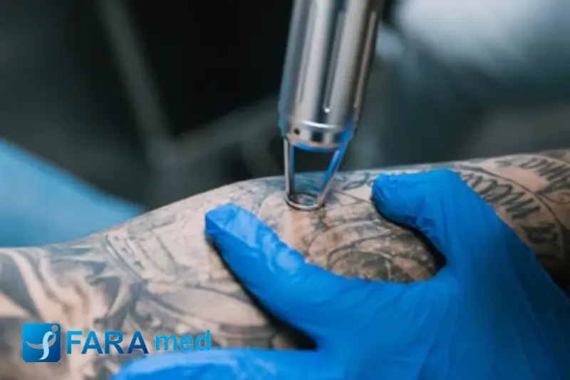 پیکوثانیه یا کیوسوئیچ؟