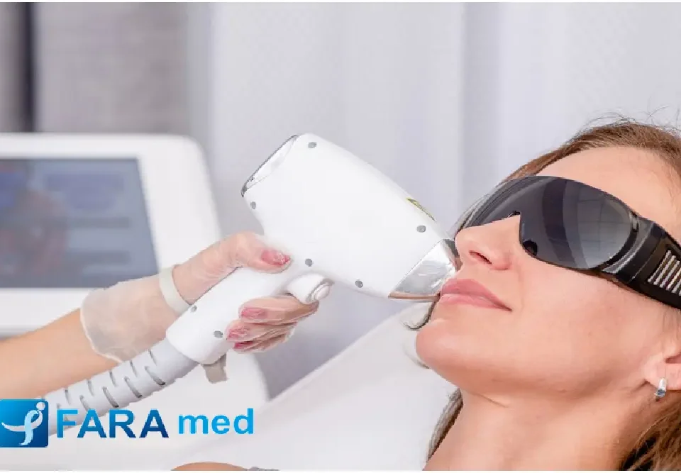 لیزر چقدر زمان میبره