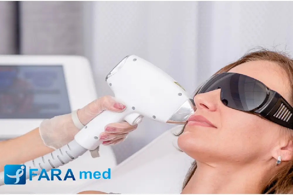 لیزر چقدر زمان میبره