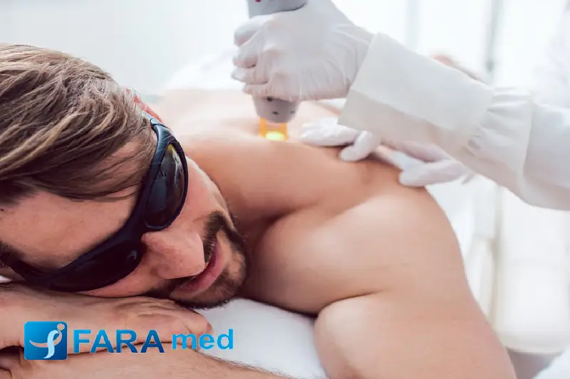 لیزر چقدر زمان میبره