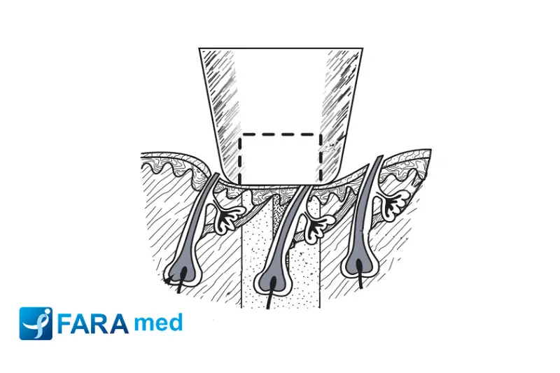 تحلیل بازگشت سرمایه در زیبایی: آنالیز هزینه – فایده تکنولوژیهای خنک کننده لیزر