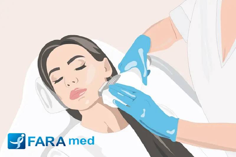 لیزر چقدر زمان میبره؟