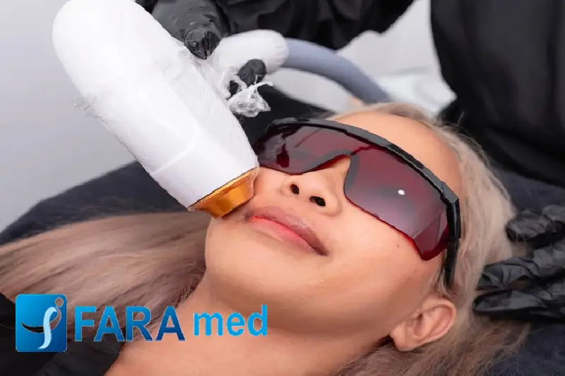 انواع دستگاه لیزر کدامند؟