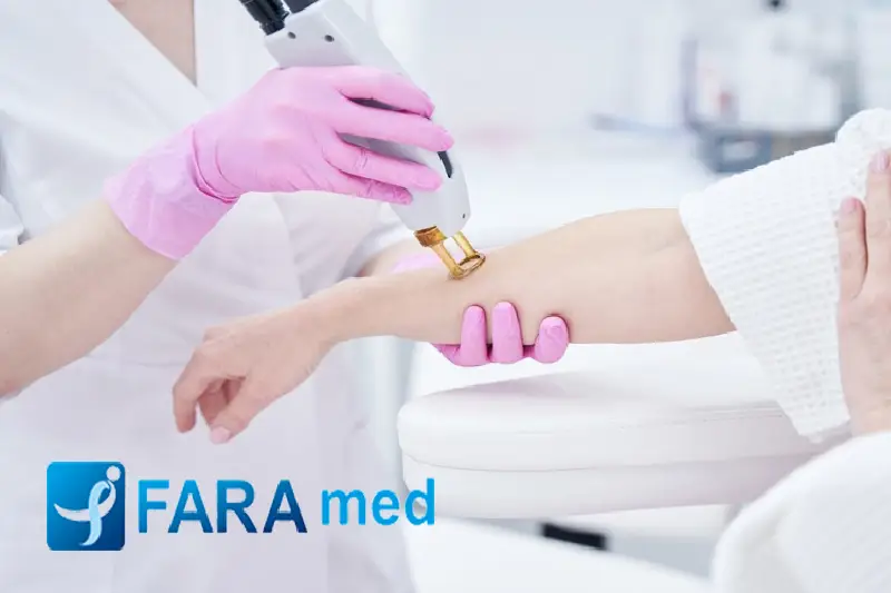 انواع دستگاه لیزر کدامند؟