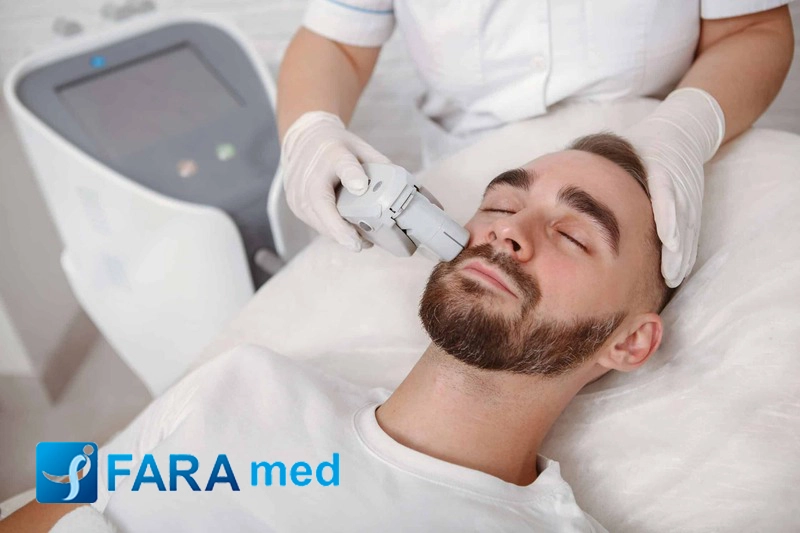 لیزر موهای زائد آقایان