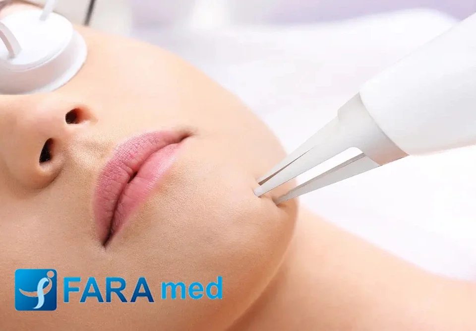 لیزر اربیوم چیست