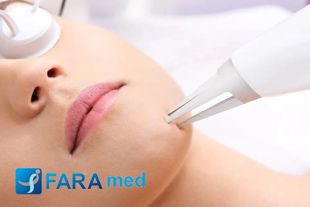 لیزر اربیوم چیست