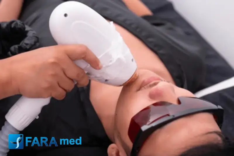 لیزر مو های زائد بدون درد