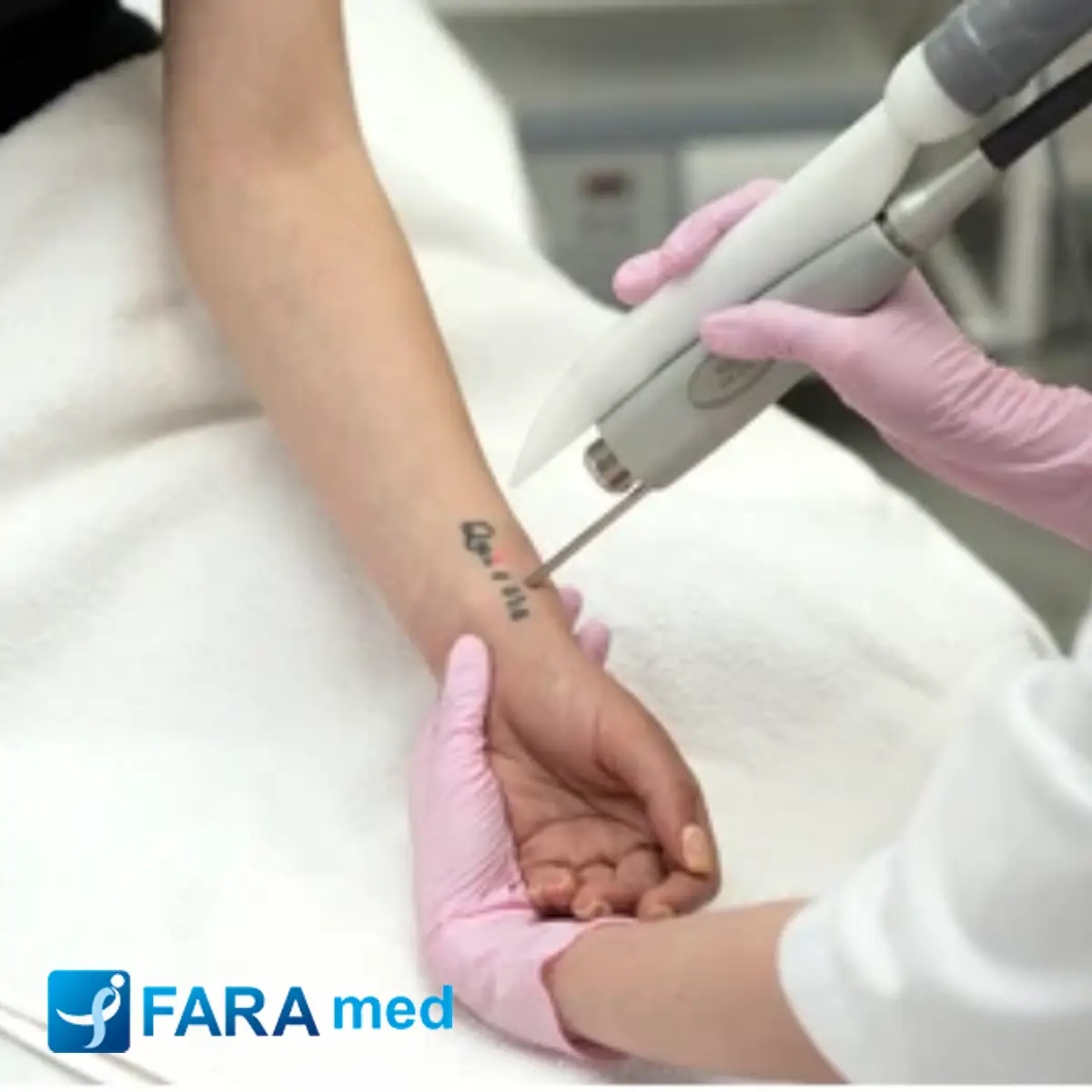 دستگاه ریمو تتو