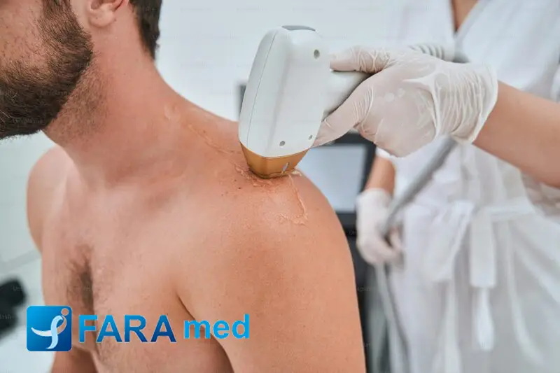 کدام دستگاه لیزر درد کمتری دارد