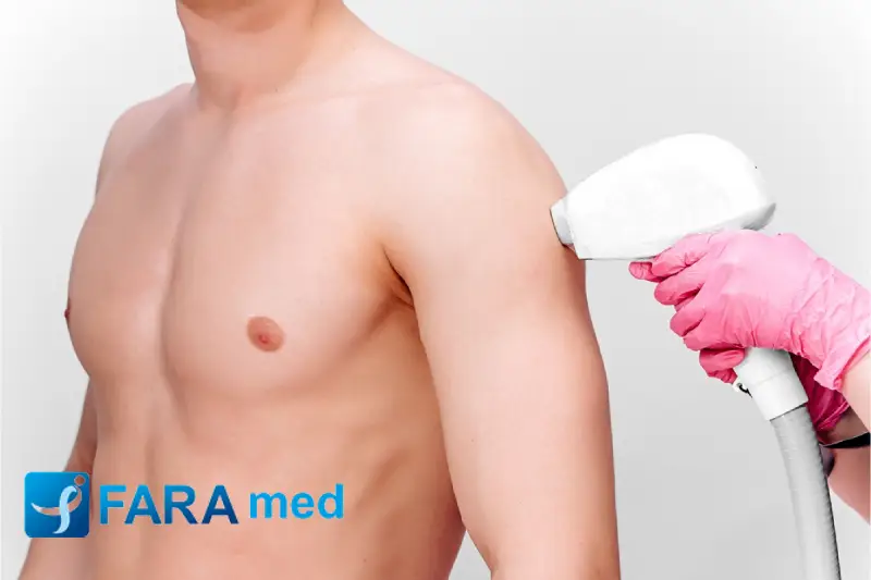 چند روز بعد از لیزر شیو کنیم؟