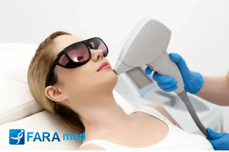 لیزر چقدر زمان میبره؟