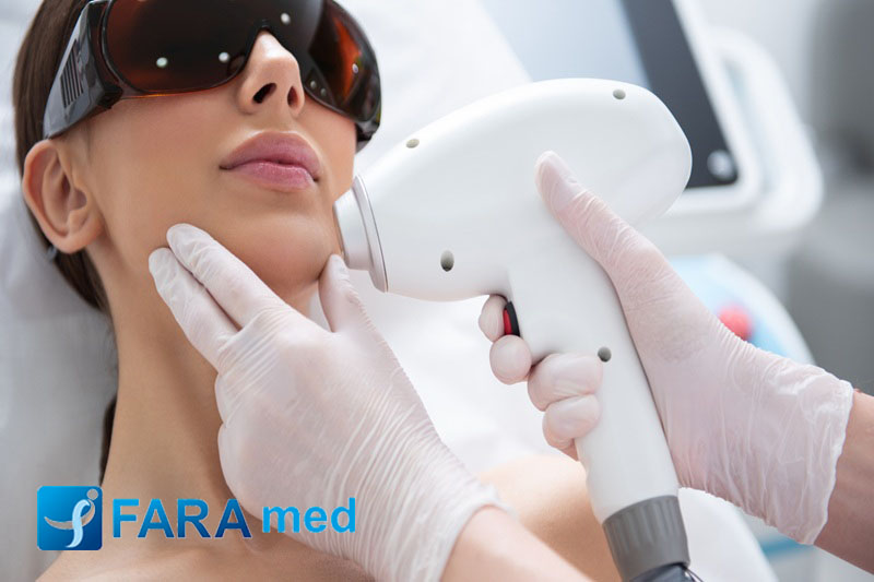 لیزر الکس مد پرو چیست