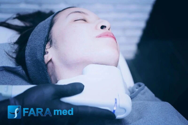 مراقبت های بعد از هایفوتراپی صورت