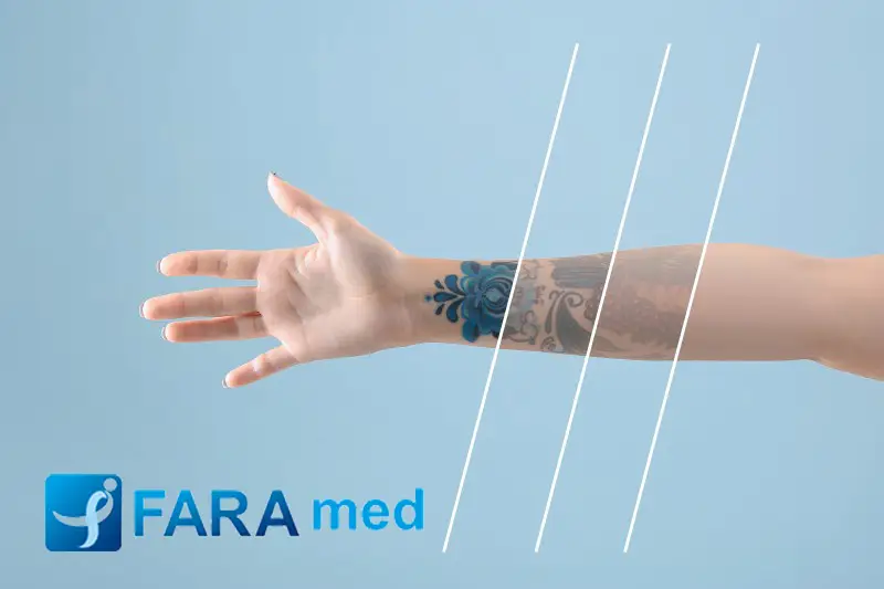 بهترین روش های پاک کردن تتو