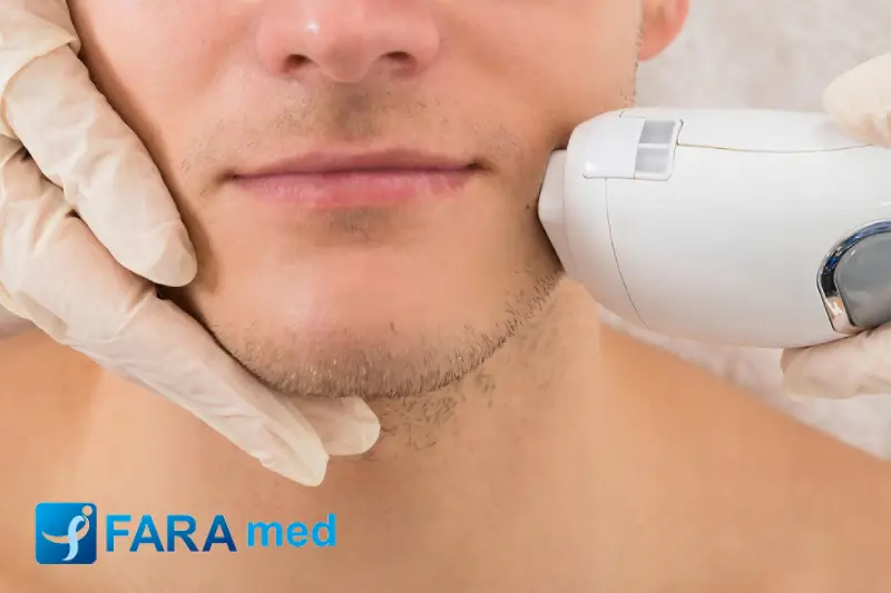 لیزر بار چیست