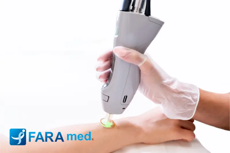 هندپیس دستگاه لیزر چیست