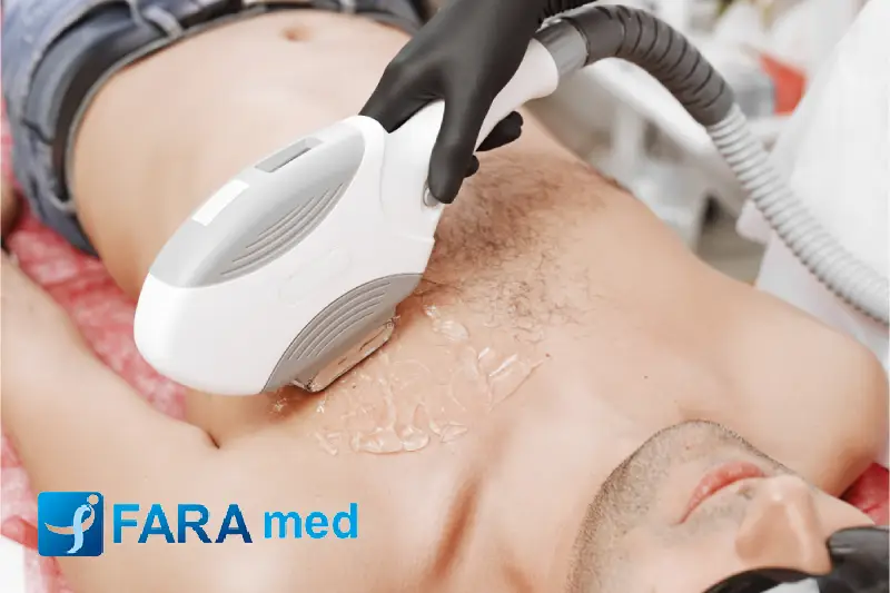 لیزر موهای زائد پوست را روشن می‌کند