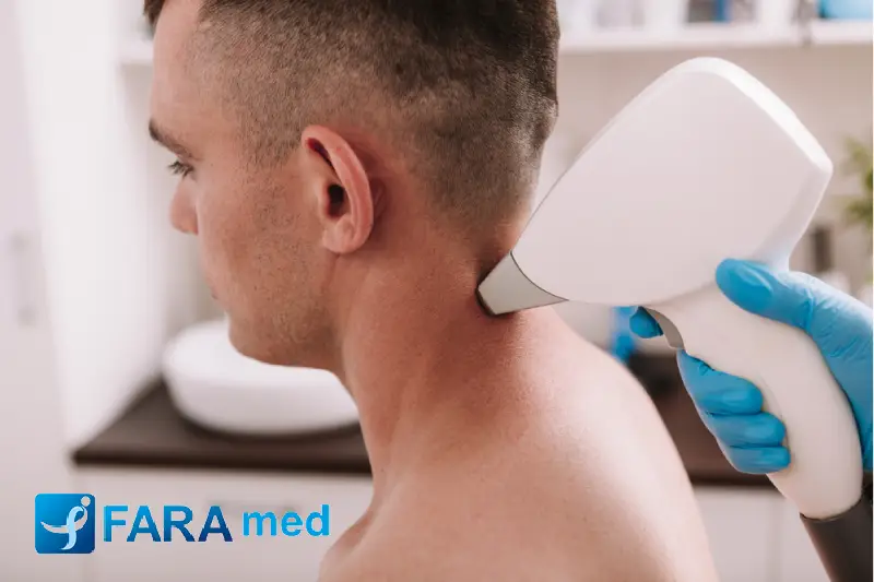 لیزر موهای زائد روی خال