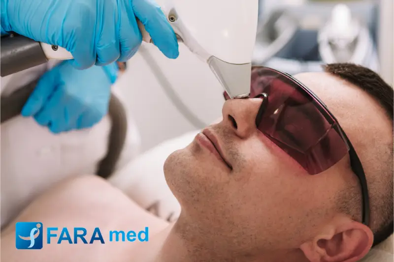 لیزر موهای زائد روی خال