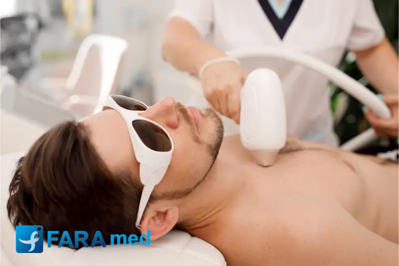 لیزر موهای زائد روی خال