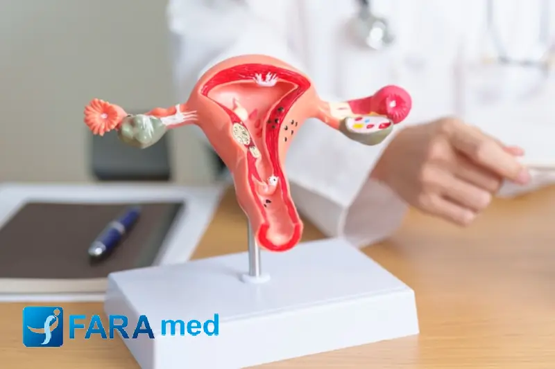 سرطان رحم چیست