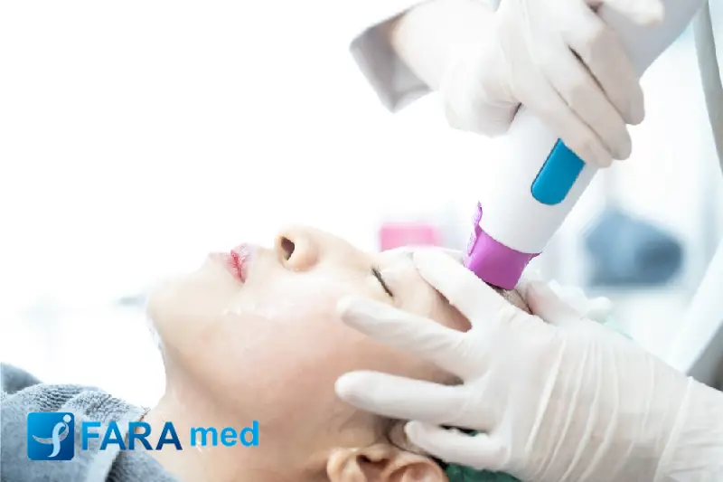 بهترین سن لیزر موهای زائد