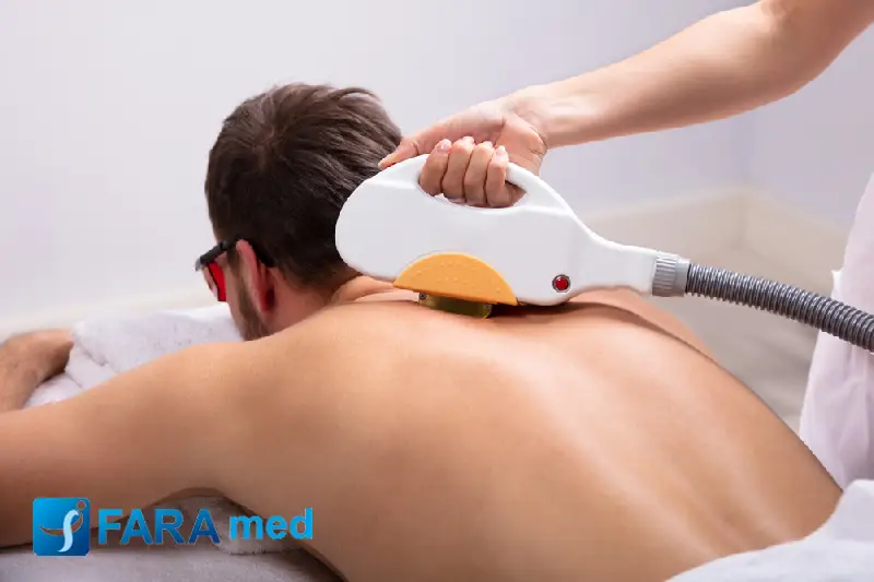 بهترین سن لیزر موهای زائد