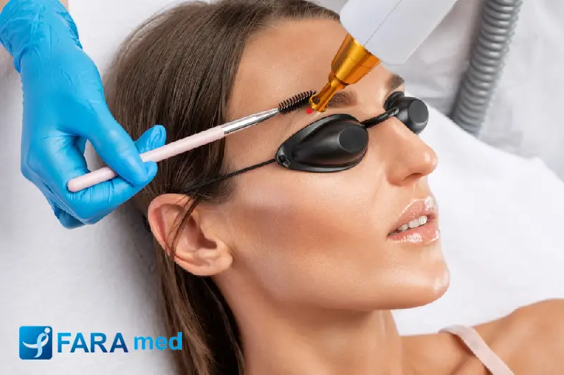 بهترین لیزر برای پاک کردن تتو چیست