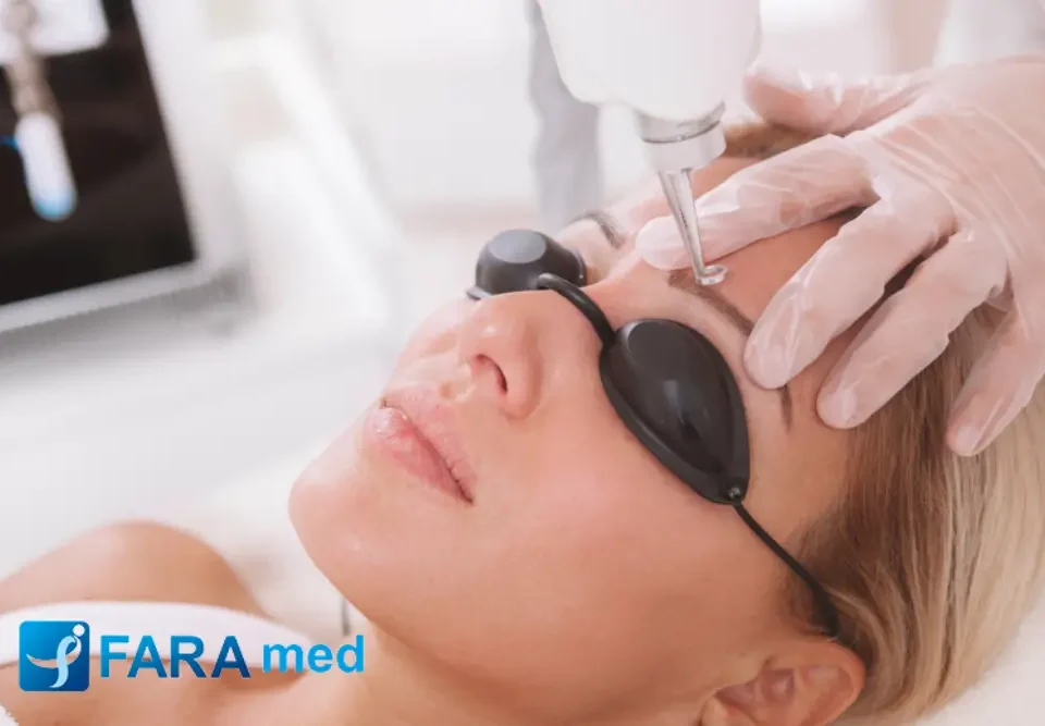 بهترین لیزر برای پاک کردن تتو چیست