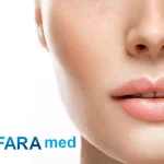 لیزر موهای زائد پشت لب