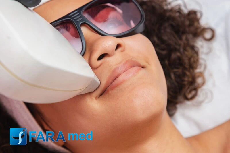 نحوه لیزر موهای پشت لب