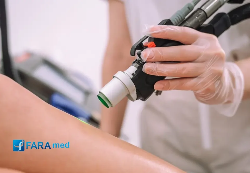 لیزر بیکینی