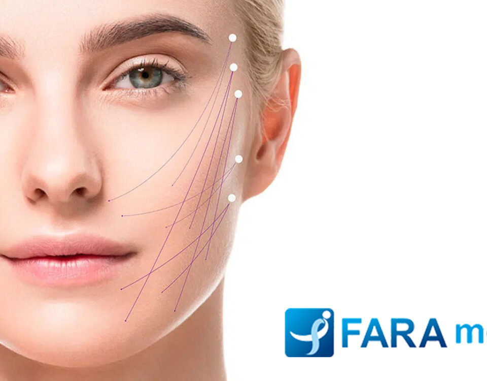 لیزر اندولیفت چیست؟