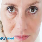 جوانسازی-پوست-با-لیزر-یا-جوانسازی-طبیعی